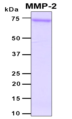 MMP2 Protein - SDS-PAGE under reducing conditions and visualized by Coomassie blue staining