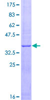 MMP2 Protein - 12.5% SDS-PAGE Stained with Coomassie Blue.