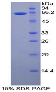 MMP2 Protein - Recombinant Matrix Metalloproteinase 2 By SDS-PAGE