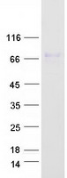MMP2 Protein - Purified recombinant protein MMP2 was analyzed by SDS-PAGE gel and Coomassie Blue Staining