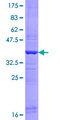 MMP21 Protein - 12.5% SDS-PAGE Stained with Coomassie Blue.