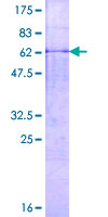 MMP23 Protein - 12.5% SDS-PAGE of human MMP23B stained with Coomassie Blue