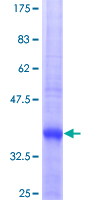 MMP23 Protein - 12.5% SDS-PAGE Stained with Coomassie Blue.