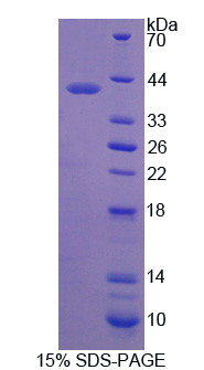 MMP23 Protein - Recombinant Matrix Metalloproteinase 23B By SDS-PAGE
