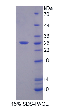 MMP23 Protein - Recombinant Matrix Metalloproteinase 21 By SDS-PAGE