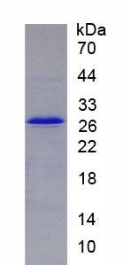MMP25 / Leukolysin Protein - Recombinant Matrix Metalloproteinase 25 (MMP25) by SDS-PAGE