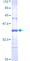 MMP26 Protein - 12.5% SDS-PAGE Stained with Coomassie Blue.