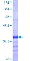 MMP28 Protein - 12.5% SDS-PAGE Stained with Coomassie Blue.