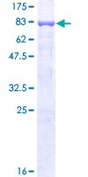 MMP3 Protein - 12.5% SDS-PAGE of human MMP3 stained with Coomassie Blue