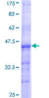 MMP3 Protein - 12.5% SDS-PAGE Stained with Coomassie Blue.