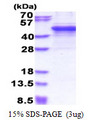 MMP3 Protein