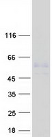 MMP3 Protein - Purified recombinant protein MMP3 was analyzed by SDS-PAGE gel and Coomassie Blue Staining