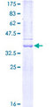 MMP7 / Matrilysin Protein - 12.5% SDS-PAGE Stained with Coomassie Blue.