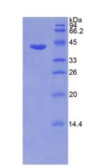MMP8 Protein - Recombinant Matrix Metalloproteinase 8 By SDS-PAGE