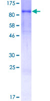 MMP9 / Gelatinase B Protein - 12.5% SDS-PAGE of human MMP9 stained with Coomassie Blue