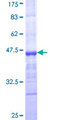 MMRN1 Protein - 12.5% SDS-PAGE Stained with Coomassie Blue.