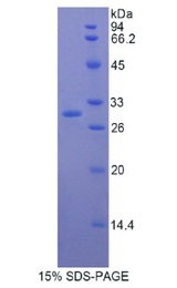 MMRN1 Protein - Recombinant Multimerin 1 By SDS-PAGE