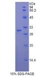 MMRN1 Protein - Recombinant Multimerin 1 By SDS-PAGE