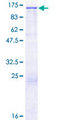 MMRN2 / Emilin 3 / EndoGlyx-1 Protein - 12.5% SDS-PAGE of human MMRN2 stained with Coomassie Blue