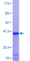 MMS2 / UBE2V2 Protein - 12.5% SDS-PAGE of human UBE2V2 stained with Coomassie Blue