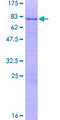 MNDA Protein - 12.5% SDS-PAGE of human MNDA stained with Coomassie Blue