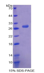 MNDA Protein - Recombinant Myeloid Cell Nuclear Differentiation Antigen By SDS-PAGE