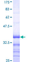 MNK / ATP7A Protein - 12.5% SDS-PAGE Stained with Coomassie Blue.