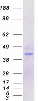 MNX1 / HB9 Protein - Purified recombinant protein MNX1 was analyzed by SDS-PAGE gel and Coomassie Blue Staining