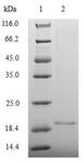MOAP1 / MAP1 Protein - (Tris-Glycine gel) Discontinuous SDS-PAGE (reduced) with 5% enrichment gel and 15% separation gel.