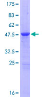 MOB1B / MOBKL1A Protein - 12.5% SDS-PAGE of human MOBKL1A stained with Coomassie Blue