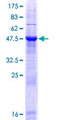 MOB2 Protein - 12.5% SDS-PAGE of human HCCA2 stained with Coomassie Blue