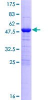 MOB4 / PHOCN Protein - 12.5% SDS-PAGE of human MOBKL3 stained with Coomassie Blue