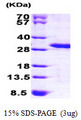 MOB4 / PHOCN Protein