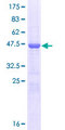 MOBKL2B / MOB3B Protein - 12.5% SDS-PAGE of human MOBKL2B stained with Coomassie Blue