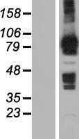 MOCOS / MoCo Sulfurase Protein - Western validation with an anti-DDK antibody * L: Control HEK293 lysate R: Over-expression lysate