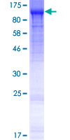 MOCOS / MoCo Sulfurase Protein - 12.5% SDS-PAGE of human MOCOS stained with Coomassie Blue