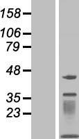 MOCS2 Protein - Western validation with an anti-DDK antibody * L: Control HEK293 lysate R: Over-expression lysate