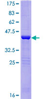 MOG1 / RANGRF Protein - 12.5% SDS-PAGE of human RANGNRF stained with Coomassie Blue