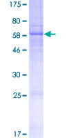 MOGAT1 / MGAT1 Protein - 12.5% SDS-PAGE of human MOGAT1 stained with Coomassie Blue