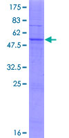 MOGAT2 Protein - 12.5% SDS-PAGE of human MOGAT2 stained with Coomassie Blue