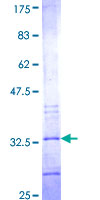 MOGAT2 Protein - 12.5% SDS-PAGE Stained with Coomassie Blue.