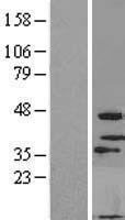 MOGAT3 Protein - Western validation with an anti-DDK antibody * L: Control HEK293 lysate R: Over-expression lysate