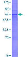 MOGAT3 Protein - 12.5% SDS-PAGE of human MOGAT3 stained with Coomassie Blue