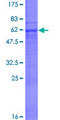 MOGAT3 Protein - 12.5% SDS-PAGE of human MOGAT3 stained with Coomassie Blue