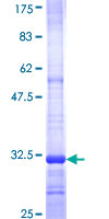 MOGAT3 Protein - 12.5% SDS-PAGE Stained with Coomassie Blue.