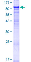 MON1A / SAND1 Protein - 12.5% SDS-PAGE of human MON1A stained with Coomassie Blue
