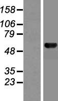 MON1B Protein - Western validation with an anti-DDK antibody * L: Control HEK293 lysate R: Over-expression lysate