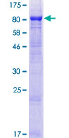 MON1B Protein - 12.5% SDS-PAGE of human MON1B stained with Coomassie Blue