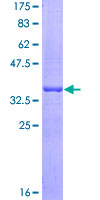 MON1B Protein - 12.5% SDS-PAGE Stained with Coomassie Blue.
