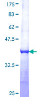 MORC1 Protein - 12.5% SDS-PAGE Stained with Coomassie Blue.